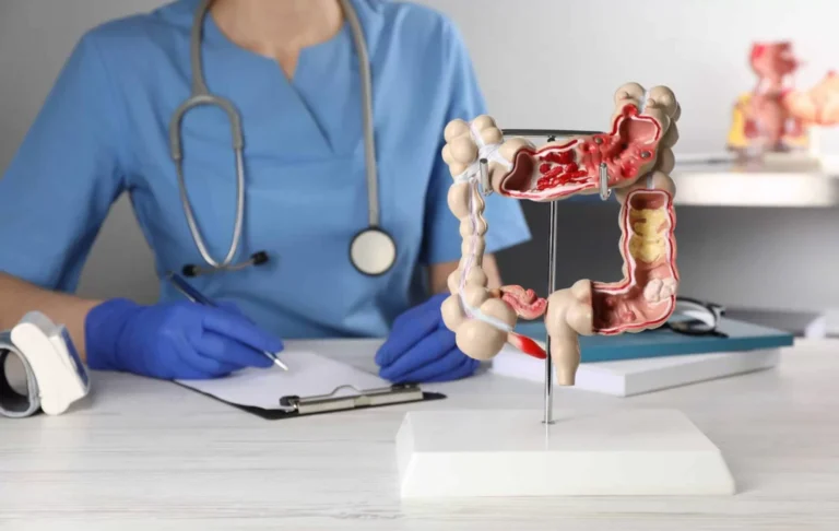 Colon Cancer