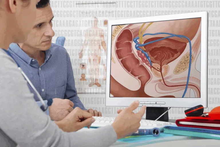 Enlarged Prostate Specialist